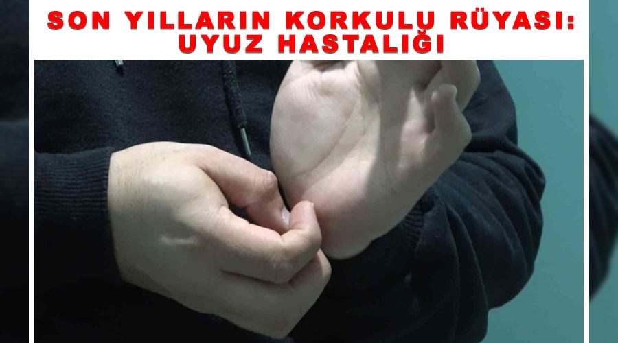 Son yılların korkulu rüyası: Uyuz hastalığı