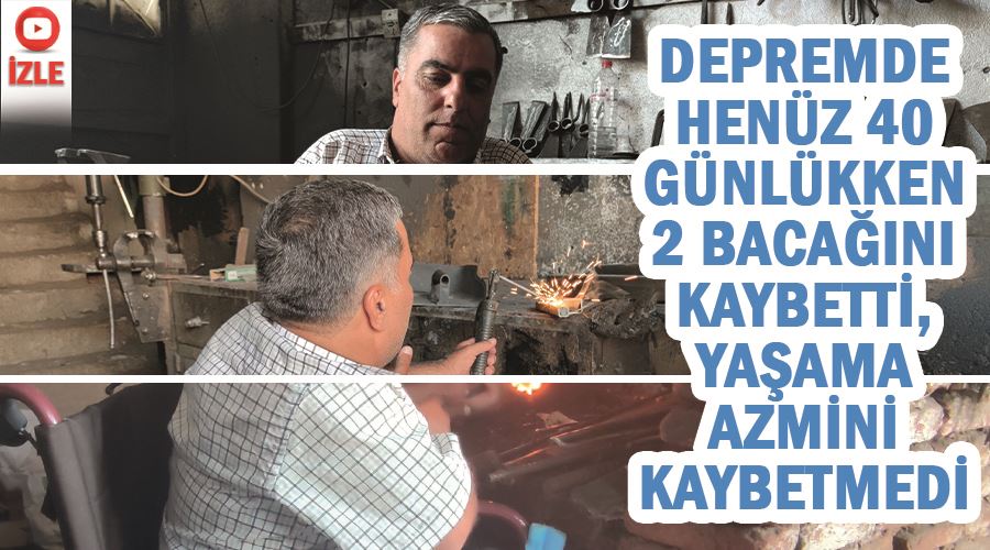Depremde henüz 40 günlükken 2 bacağını kaybetti, yaşama azmini kaybetmedi