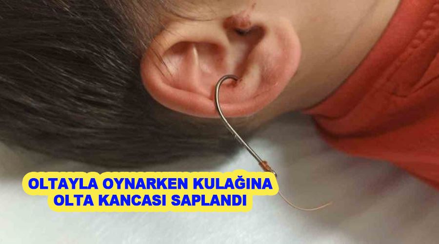 Oltayla oynarken kulağına olta kancası saplandı