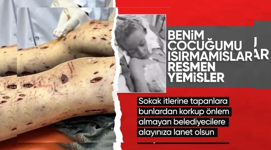 Köpeklerin saldırdığı Tunahan