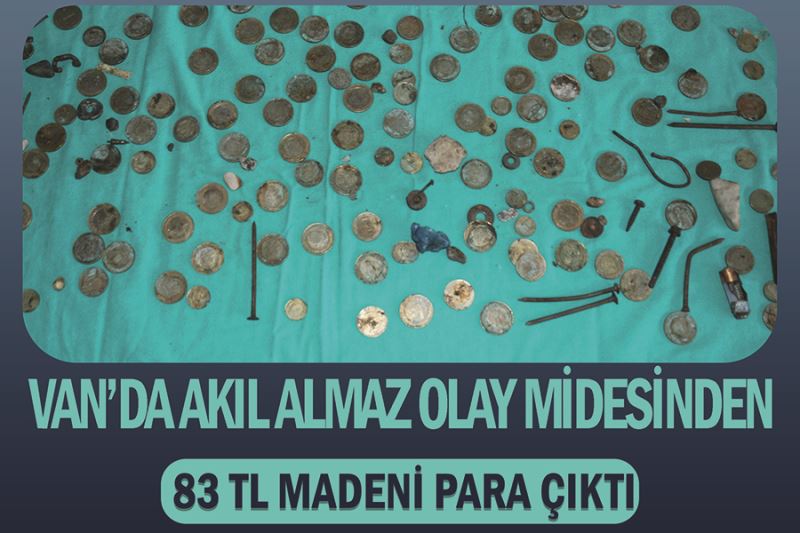 Van’da akıl almaz olay Midesinden 83 TL madeni para çıktı